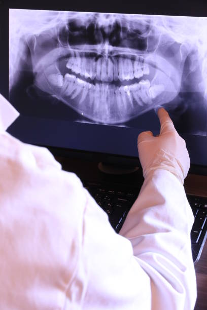 Best Emergency Root Canal Treatment in Townsend, MT