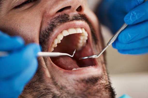 Best Emergency Treatment for Dental Infections or Abscesses in Townsend, MT