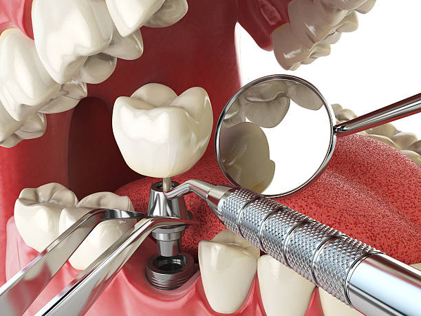 Best After-Hours Dental Trauma Care in Townsend, MT